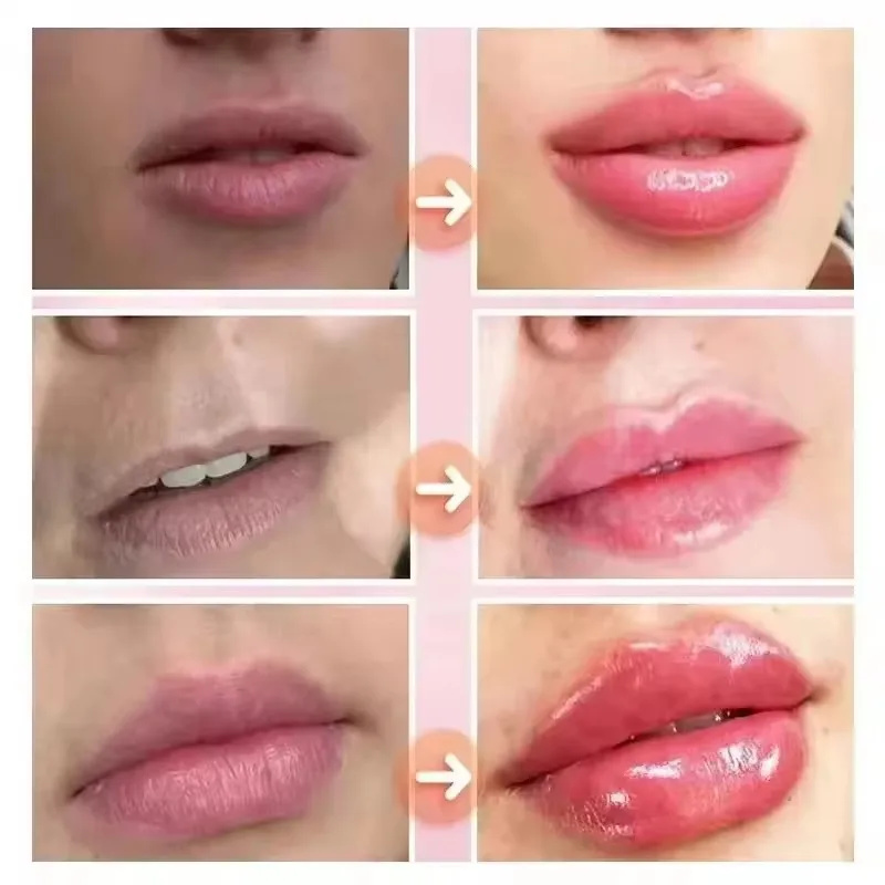 Olio essenziale rimpolpante pe - Lip Gloss Plumping recensione e prezzo